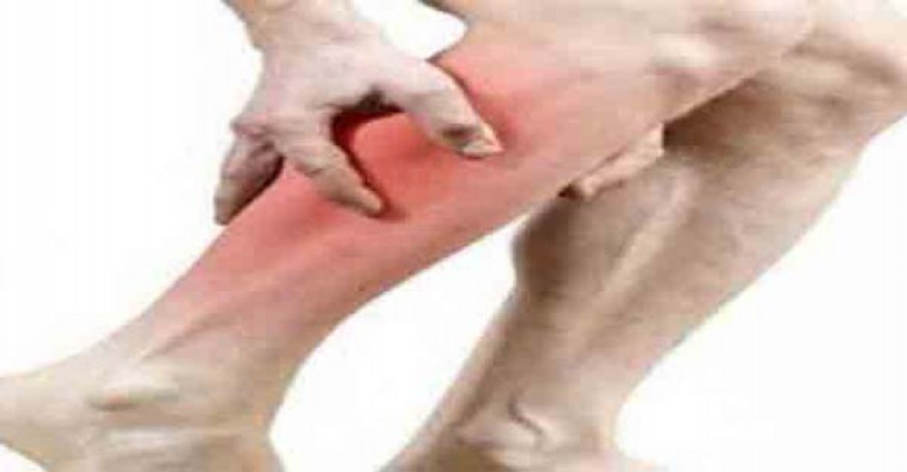 পানির অভাব ছাড়াও পেশিতে টান পড়ে, কি করবেন ?